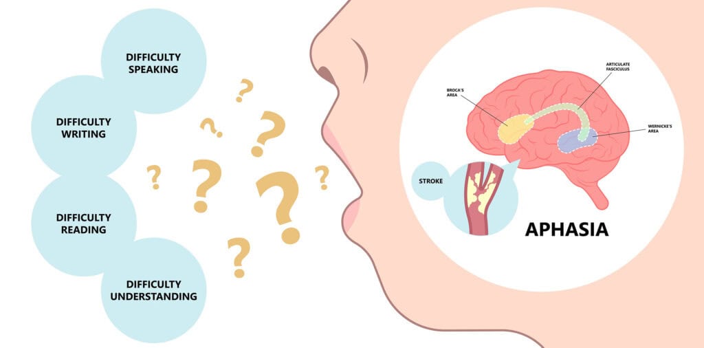 Aphasia
