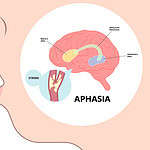 Aphasia